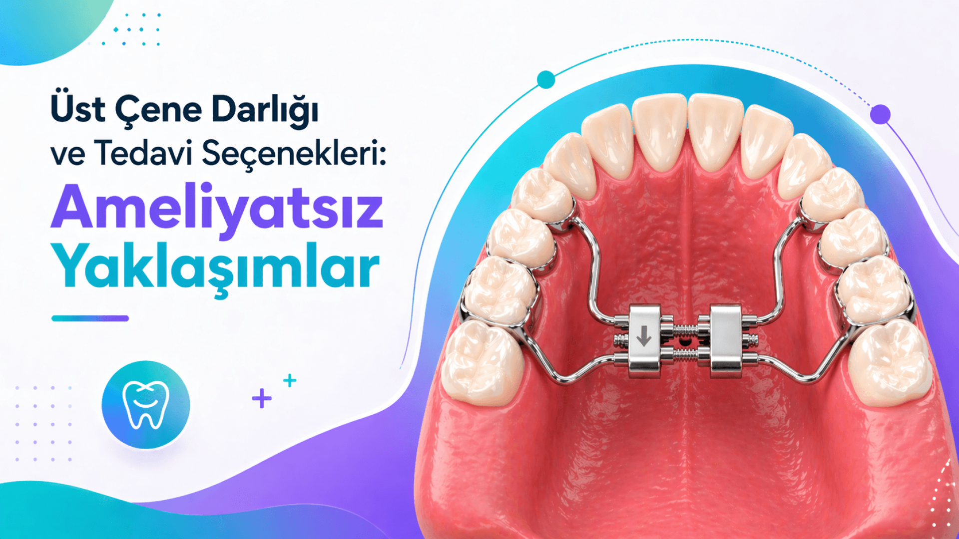 Üst Çene Darlığı ve Tedavi Seçenekleri: Ameliyatsız Yaklaşımlar