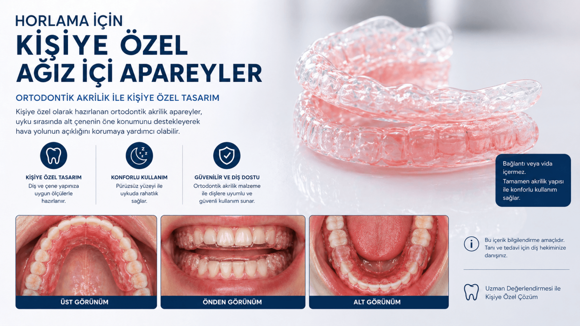 Horlama İçin Kişiye Özel Ağız İçi Apareyler