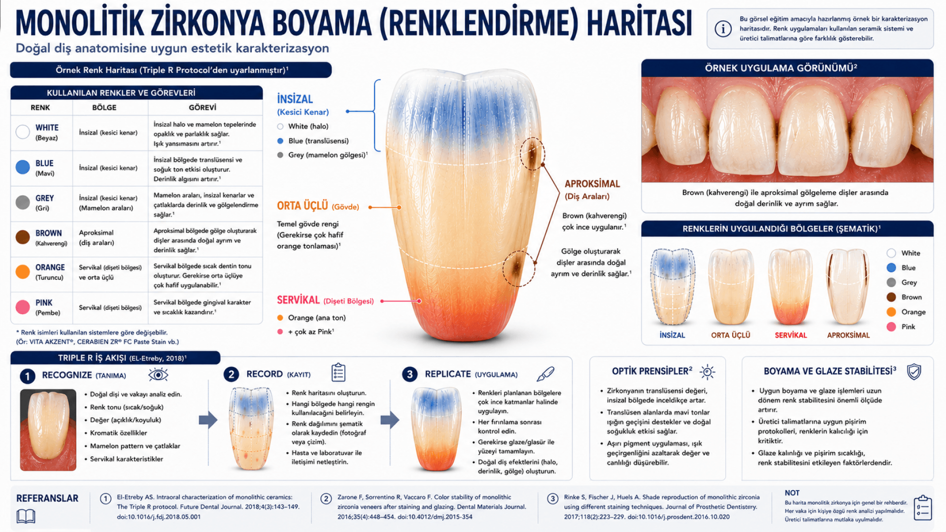 Monolitik Zirkonya Restorasyonlarda Estetik Karakterizasyon Yaklaşımı