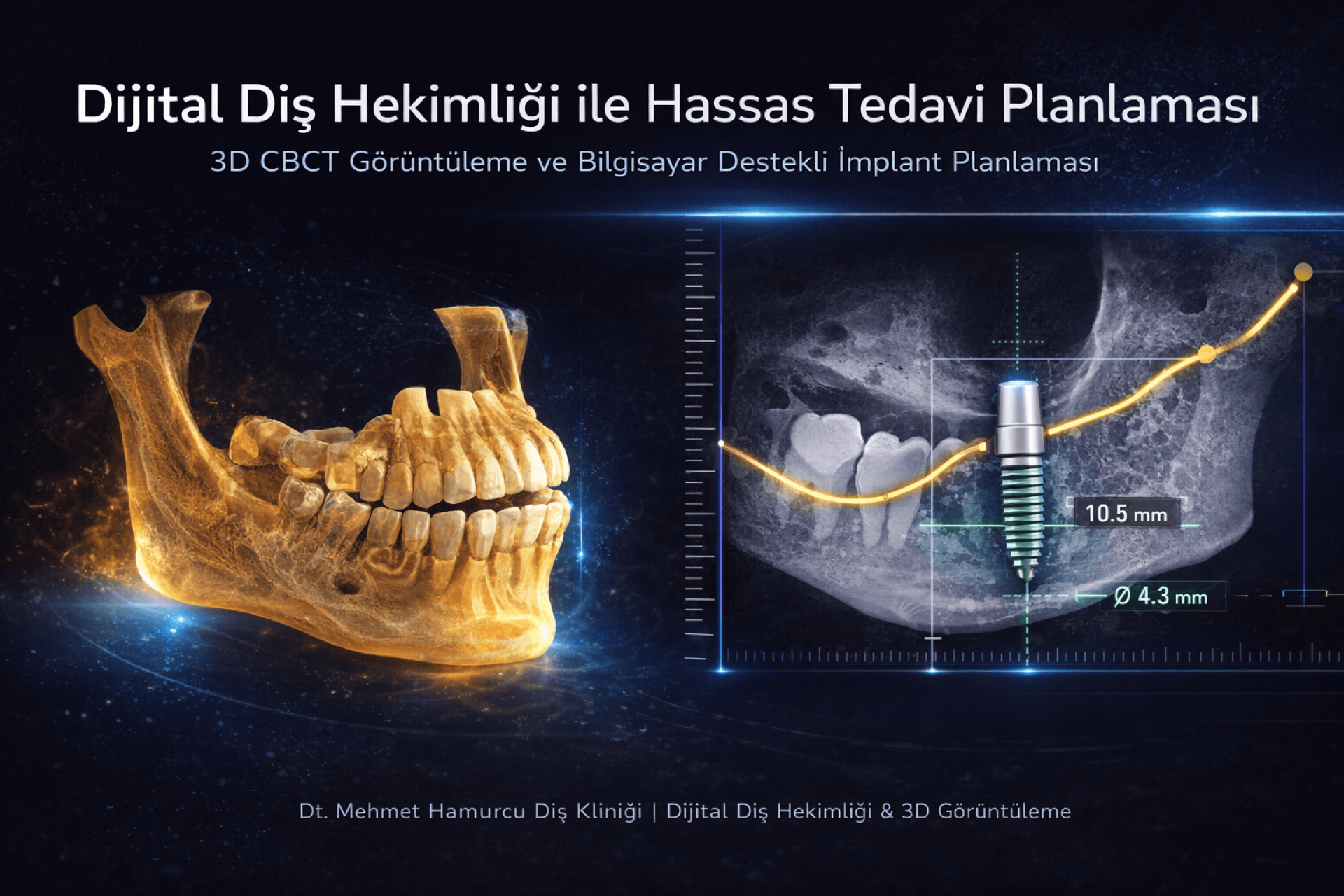 3B Diş ve Çene Tomografisi