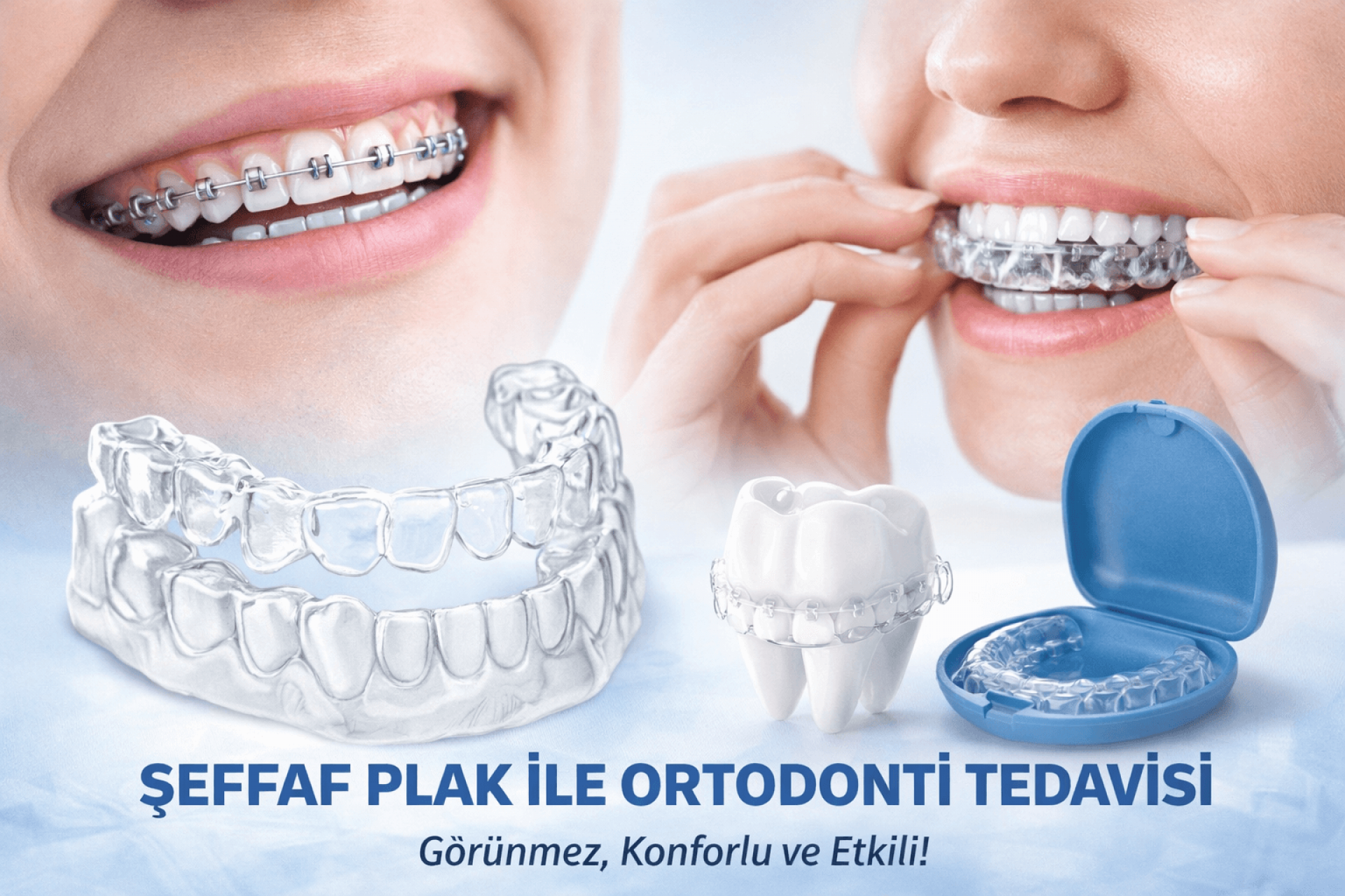 Şeffaf Plak ile Ortodonti Tedavisi