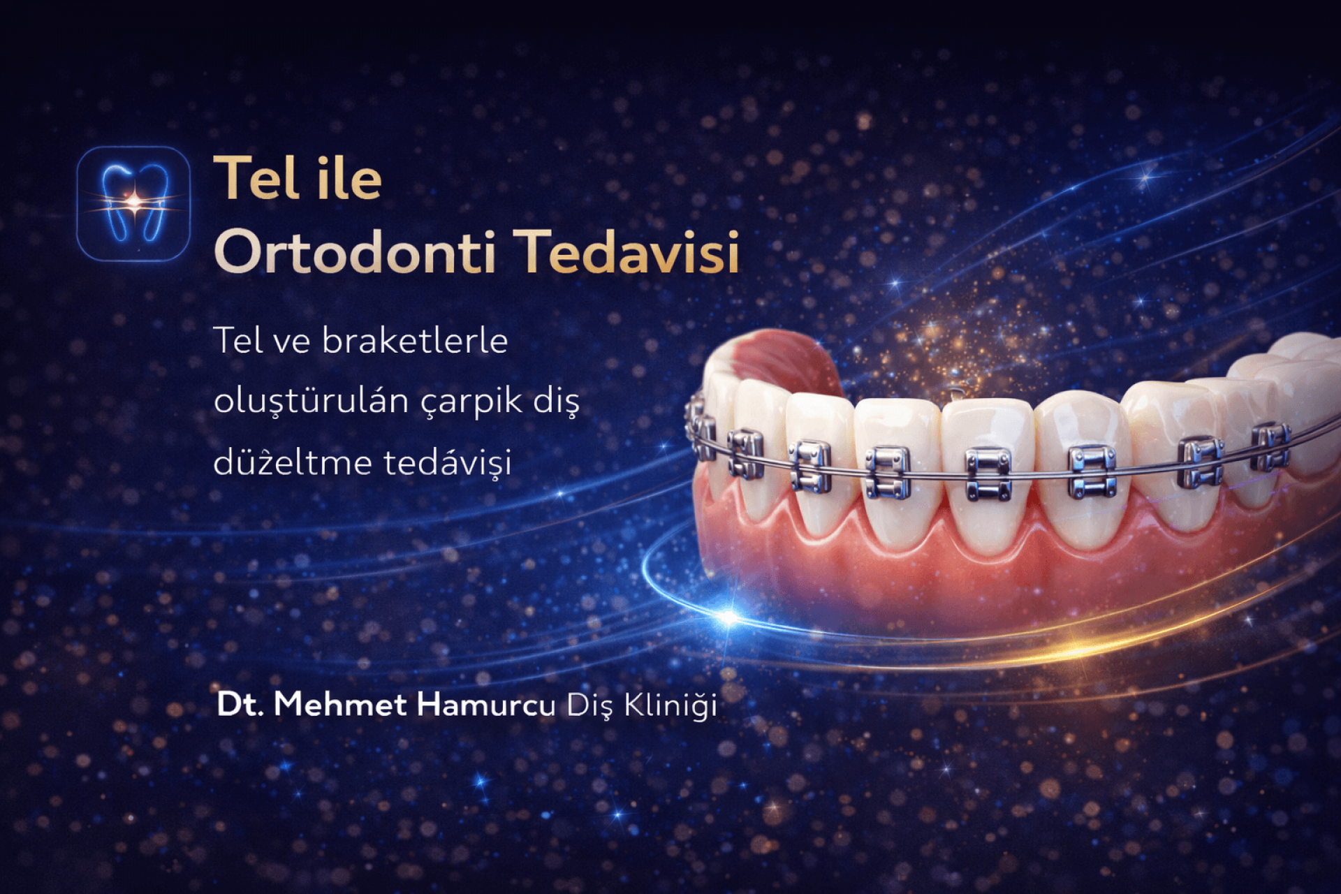 Tel ile Ortodonti Tedavisi