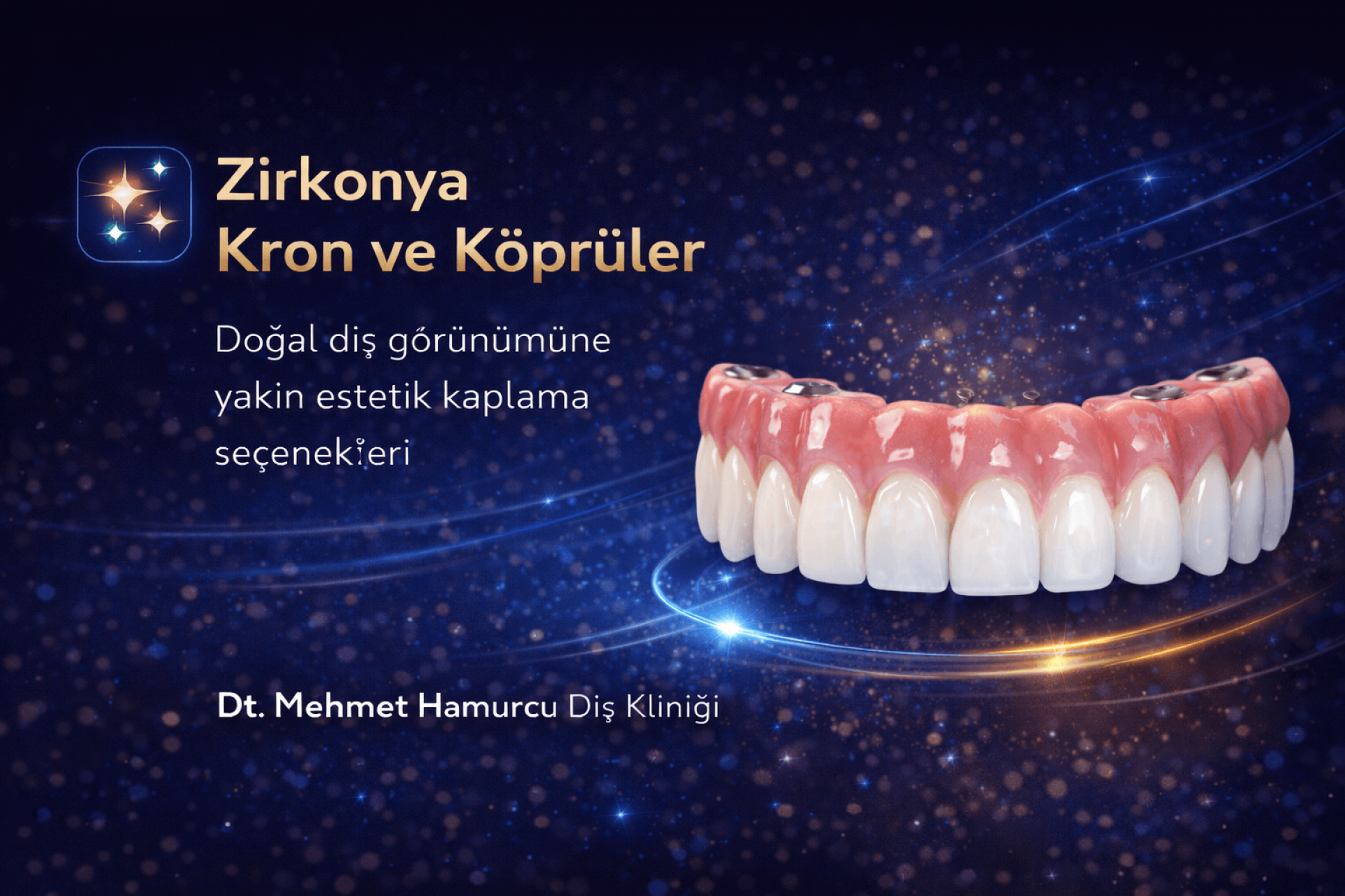 Zirkonya Kron ve Köprüler